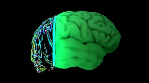 MRI scan of the brain Stock Illustration