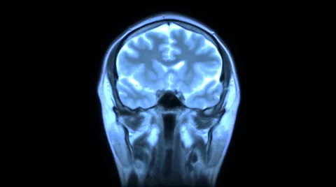 MRI scan Stock-Footage 958339