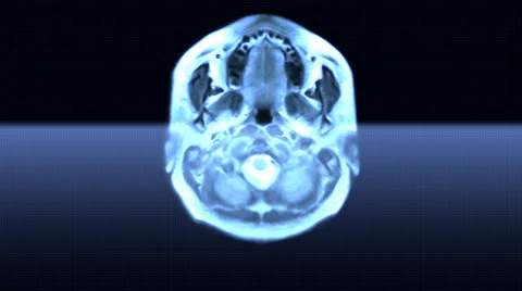 MRI scan Stock-Footage 958547