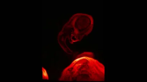 Mri Scan. Human Brain. RMN Scan. Stock Footage 135061085