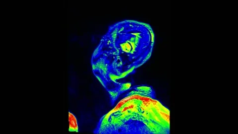 Mri Scan. Human Brain. RMN Scan. Stock Footage 135061189
