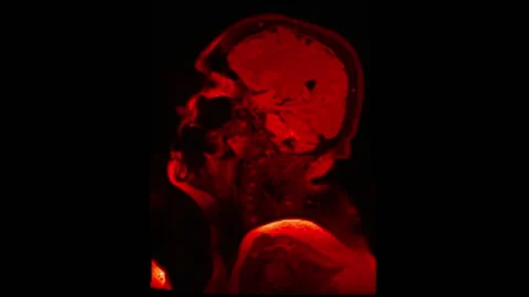 Mri Scan. Human Brain Scan. 스톡 동영상 135061129