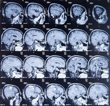 Mri scan image Stock Photos