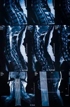 MRI scan Stock Photos