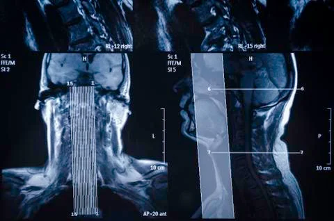 MRI scan Stock Photos