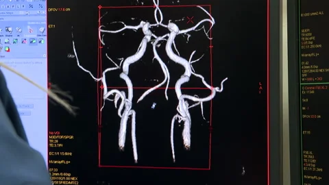 MRI scan screen animation. Computed medical tomography MRI.  Stock Footage 168366846