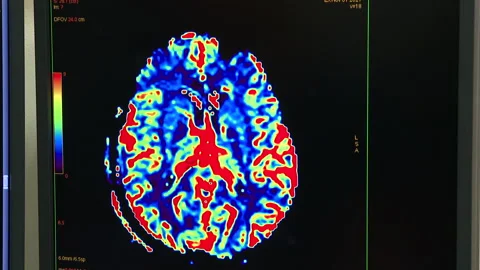 MRI scan screen animation. Computed medical tomography MRI. Stock Footage 168366853