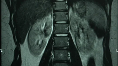 MRI scan screen animation. Computed medical tomography MRI. 스톡 동영상 168366972