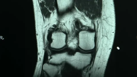 MRI scan screen animation. Computed medi... | Stock Video | Pond5