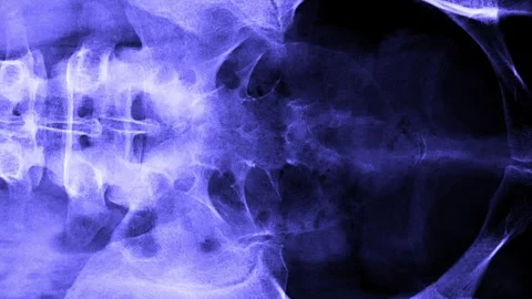 MRI scan timelapse of various sides human body, spine, coccyx bones, pelvis.. Stock Footage 267297884
