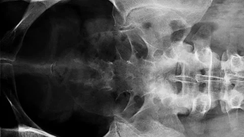 MRI scan timelapse of various sides human body, spine, coccyx bones, pelvis.. Stock Footage 288031338