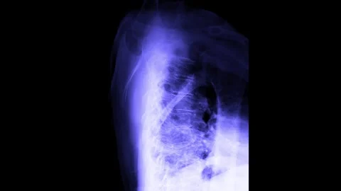 MRI scan timelapse of various sides human body, spine, coccyx bones, pelvis.. Stock Footage 288031579