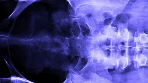 MRI scan timelapse of various sides human body, spine, coccyx bones, pelvis.. Stock Footage 302657870