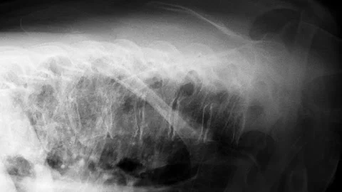 MRI scan timelapse of various sides human body, spine, coccyx bones, pelvis.. Stock Footage 302657872