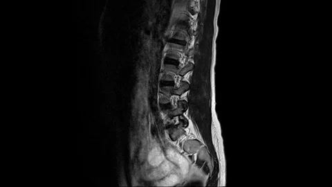 Mri scan of a young woman's spinal column from the side 스톡 동영상 124868685