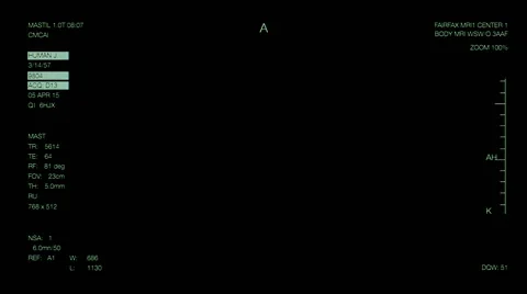 MRI scaner info-graphics Stock-Footage 55201437