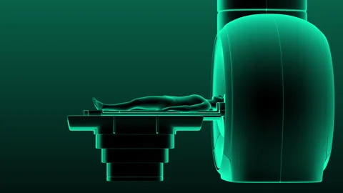 MRI SCANNER Stock Footage 245558826