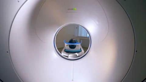 MRI scanner, tomograph with patient getting medical exam. Video stock 85798494