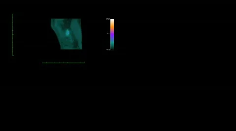 MRI scanner at work Stock Footage