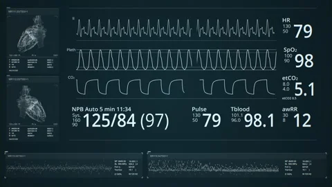MRI scanning. Dynamic Heart beat line, pulsating heart. Cardiogram signal Stock Footage 159277990