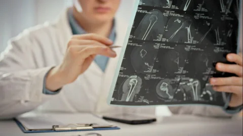 MRI scans and X-ray images line the bright walls of medical office as doctor Stock Footage 346959331