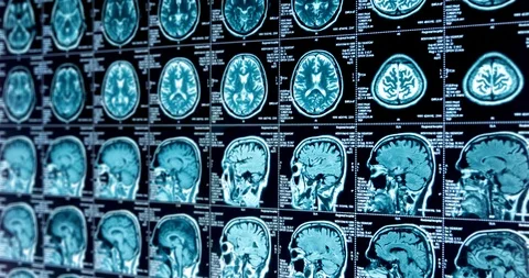 MRI scans of various sizes scroll down, looped Stock Footage 106322002