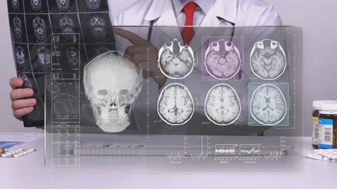 MRI Screen  動画素材 200748559