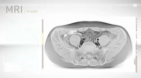 MRI Screendesign Video stock 8536001