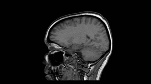MRI of the skull in motion loop. Lateral imaging brain. Stock Footage 200960032