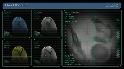 MRI/medical scan of a human shoulder. Vídeos de archivo 52097317