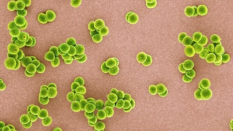 MRSA bacteria, SEM Stock Footage 75605276