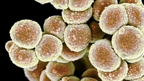 MRSA bacteria, SEM Stock Footage 75605727