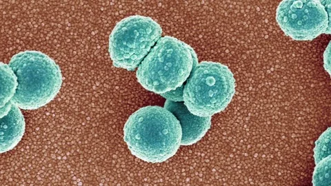 MRSA bacteria, SEM Stock Footage 75605822