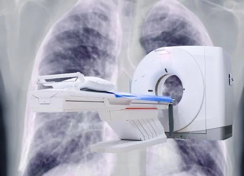 Multi detector CT Scanner ( Computed Tomography ) on chest x-ray background f Stock Photos