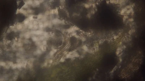 Multiple colonies of infusoria and bacteria eat the corpse of the mite Stock Footage 122013905