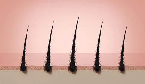 Multiple damaged hair strands with split ends on skin - 3d illustration Stock Illustration