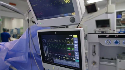 Multiple diverse parameters of a patient under operation.  Stock Footage 212935122
