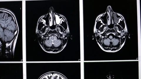 Multiple magnetic resonance scan Stock Footage 85321332