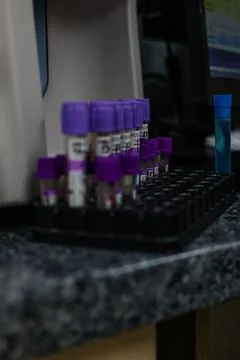 Multiple purple-capped test tubes containing blood samples sit in a black rack Stock Photos