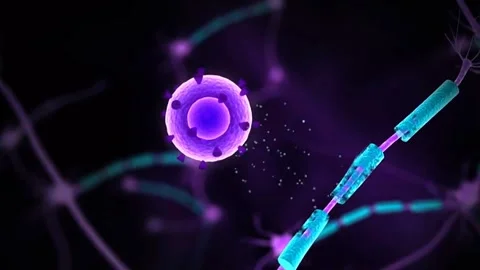 Multiple sclerosis causes and symptoms Stock Footage 319704348