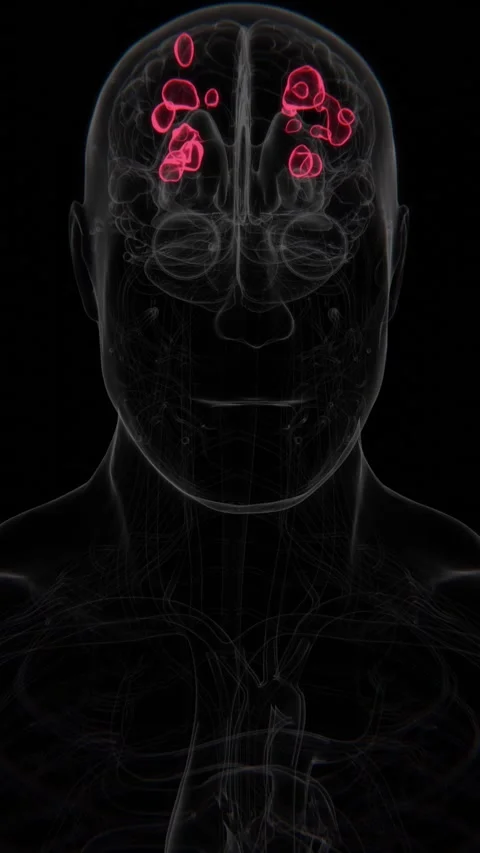 Multiple Sclerosis Indication in brain X-ray in Vertical Video | Multiple Stock Footage 302148843