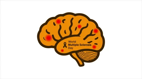 Multiple sclerosis world day brain Video stock 337583192