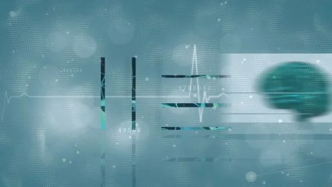 Multiple screens with medical data processing over heart rate monitor against 動画素材 328822194