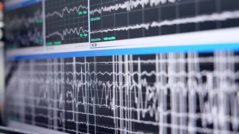 Multiple white curved lines run on the large monitor.  Stockbeeldmateriaal 307941060