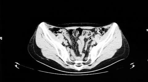 Multispectral computed tomography human internal organs 1 Stock Footage 47163449