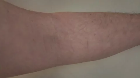 Muscle Contraction Visible on an Arm During Physical Activity Session Stock Footage 301404124