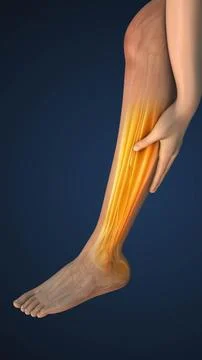 Muscle cramp in the leg Stock Illustration
