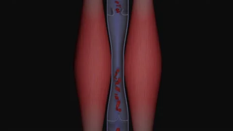 Muscle Pump: The Mechanism for Efficient Venous Return Video stock 230302530