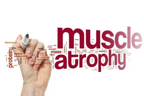 Muscleatrophy Illustrazione stock