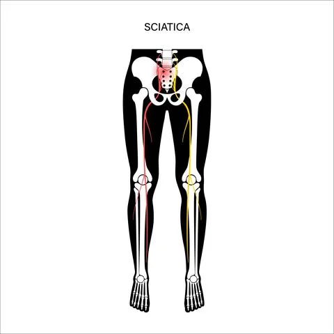 Muscular pelvis sciatica Stock Illustration